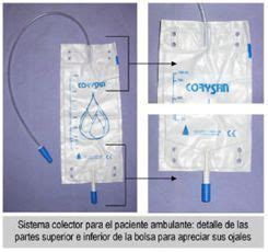 sonda vesical mujer real|Sonda Foley: Tipologías, características y métodos de。